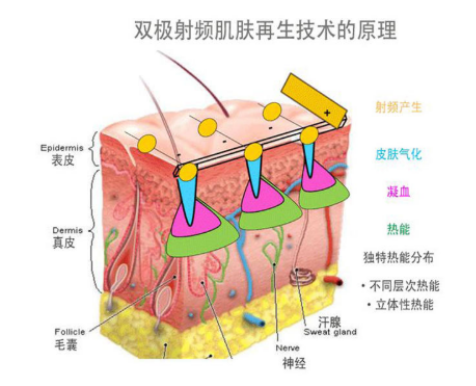 李佳齐推荐的便携式美容仪,欧姆龙轻触开关性价比王炸!